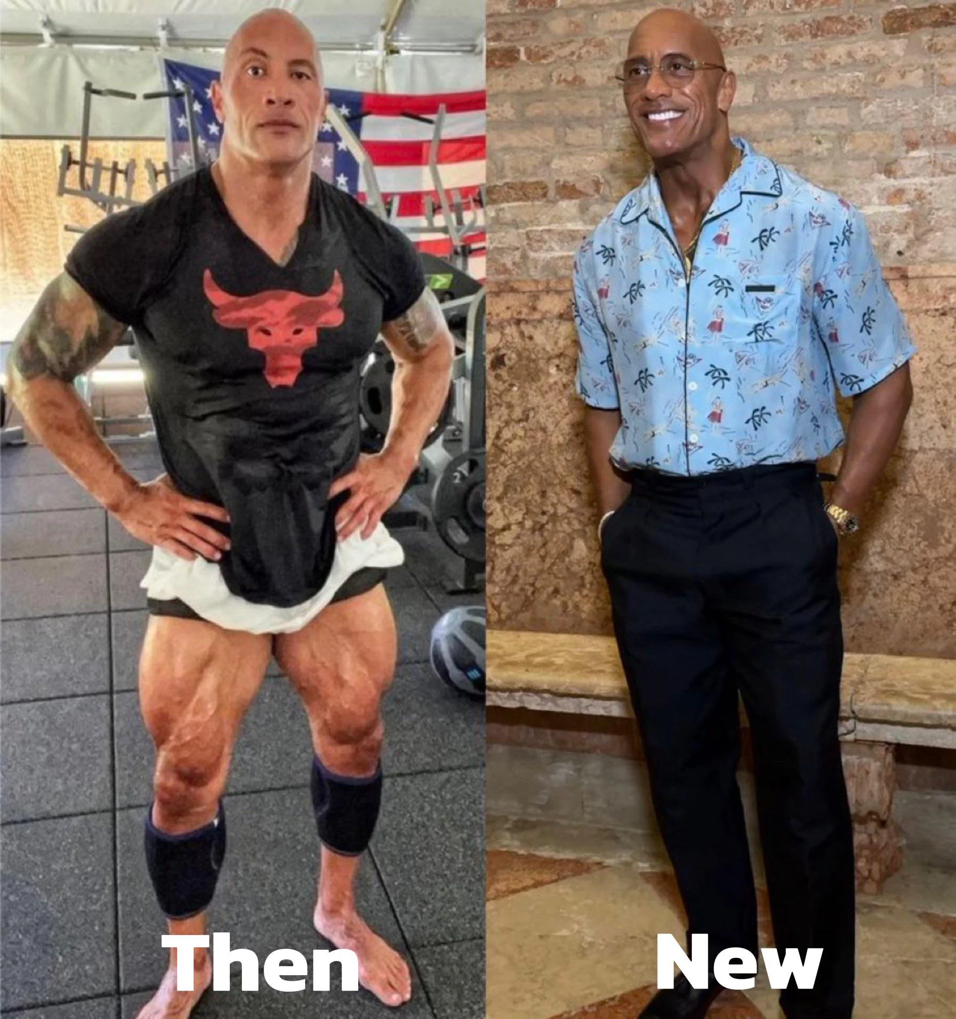 Patient 3 before and after photo placeholder