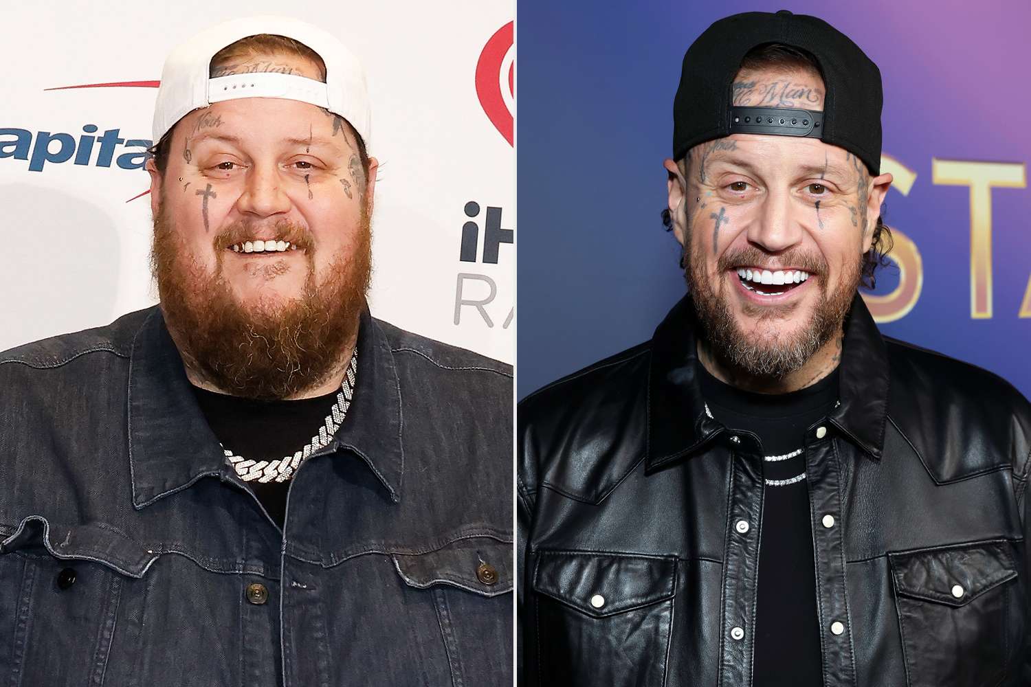 Patient 4 before and after photo placeholder